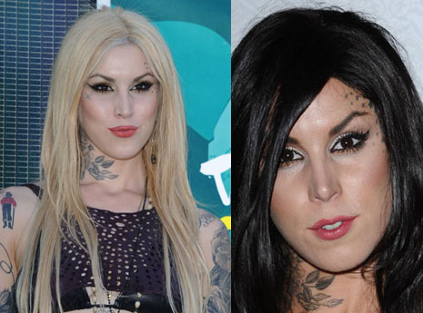 kat von d plastic surgery